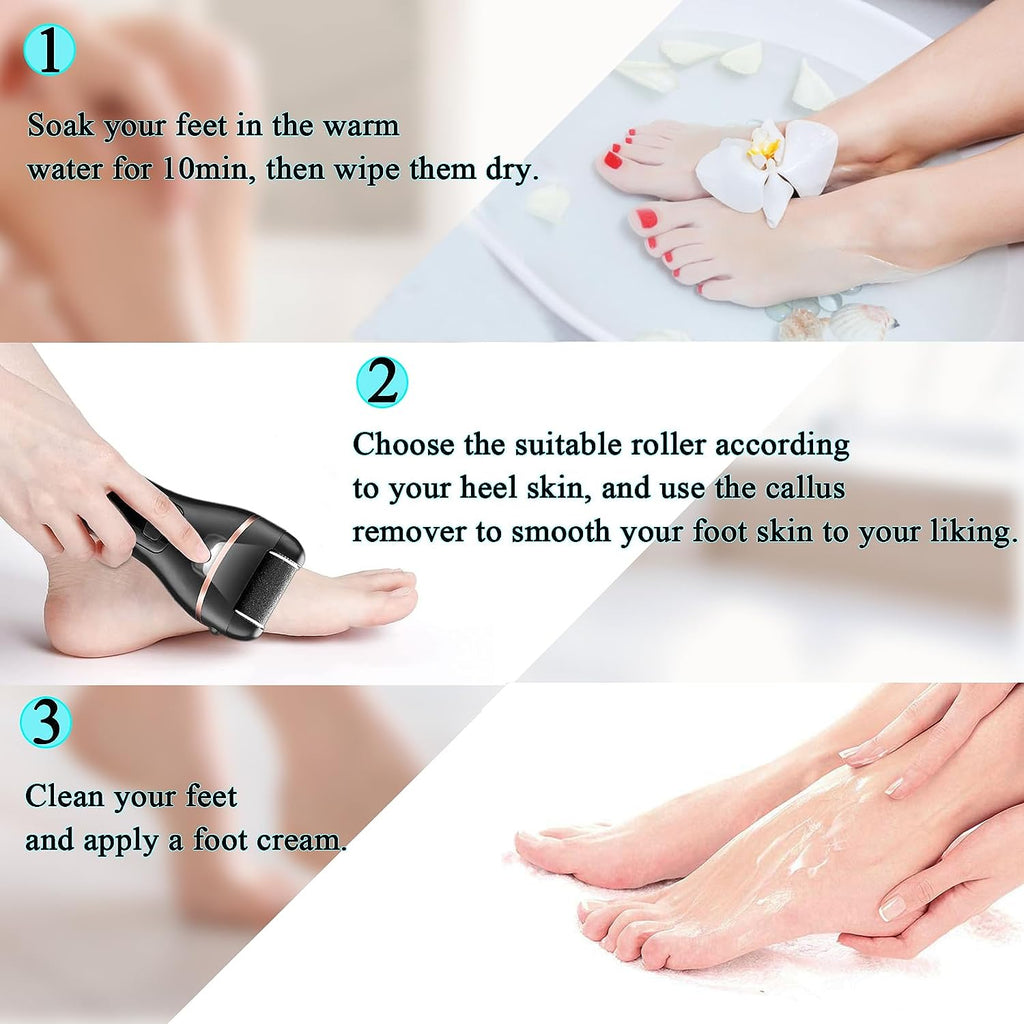 Get Beautifully Smooth Feet with CIVYPRO 13-In-1 Callus Remover - Professional Foot Care Kit for Soft, Supple Skin! 3 Rollers, 2 Speeds, and Battery Display for an Effortless Pedicure Experience!"